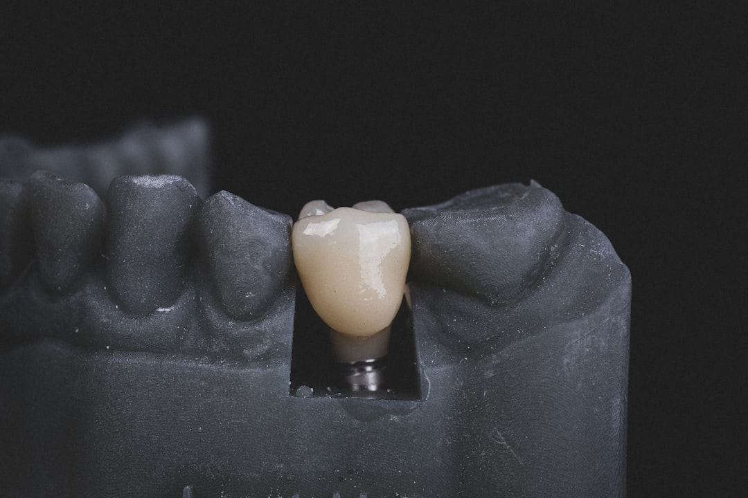 Zirconia Crowns & Ceramic Bridges