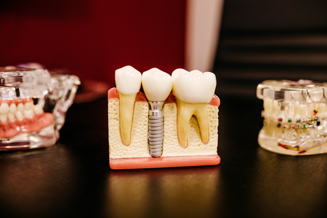 Advanced Dental Implants