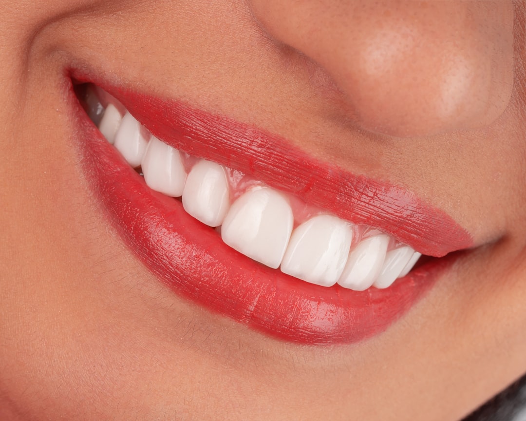 Laser & In-Clinic Teeth Whitening